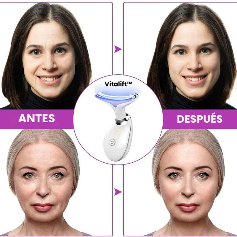 Masajeador Facial 3 en 1 - VitaLift™